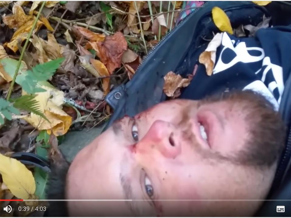 Kuva Kevin Diepenbrockin videolta vakavan moottoripyöräonnettomuuden jälkeen.